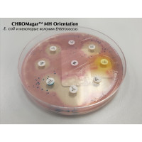 CHROMagar MH Orientation и Вентилятор-ассоциированная пневмония CHROMagar MH Orientation и Вентилятор-ассоциированная пневмония